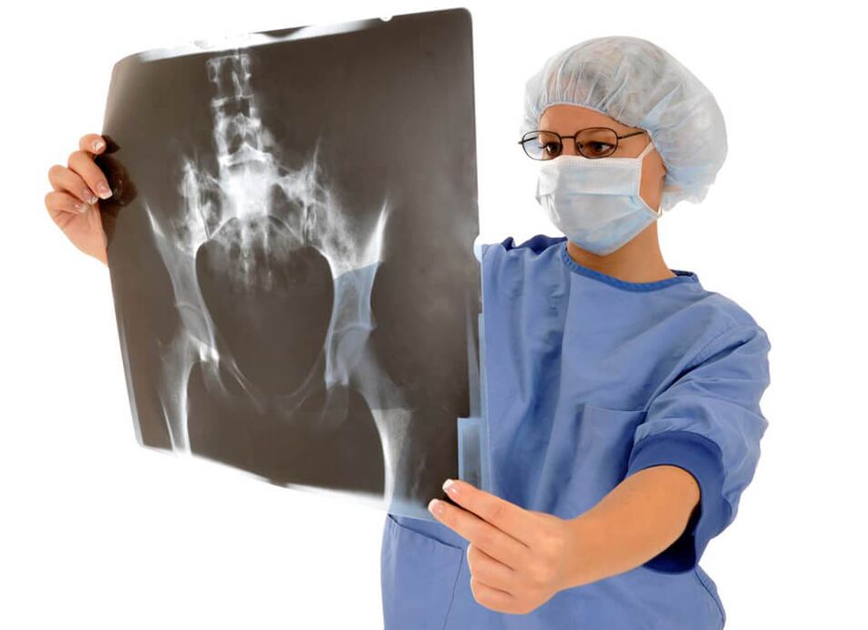 Рентгенограмма жамбаш муундун дарыгерге жардам берет аныктоого себебин оору